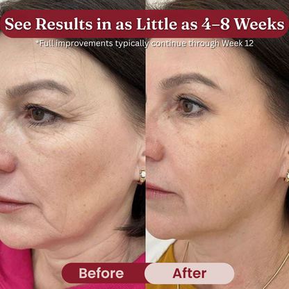 Get Your Youthful Skin Back