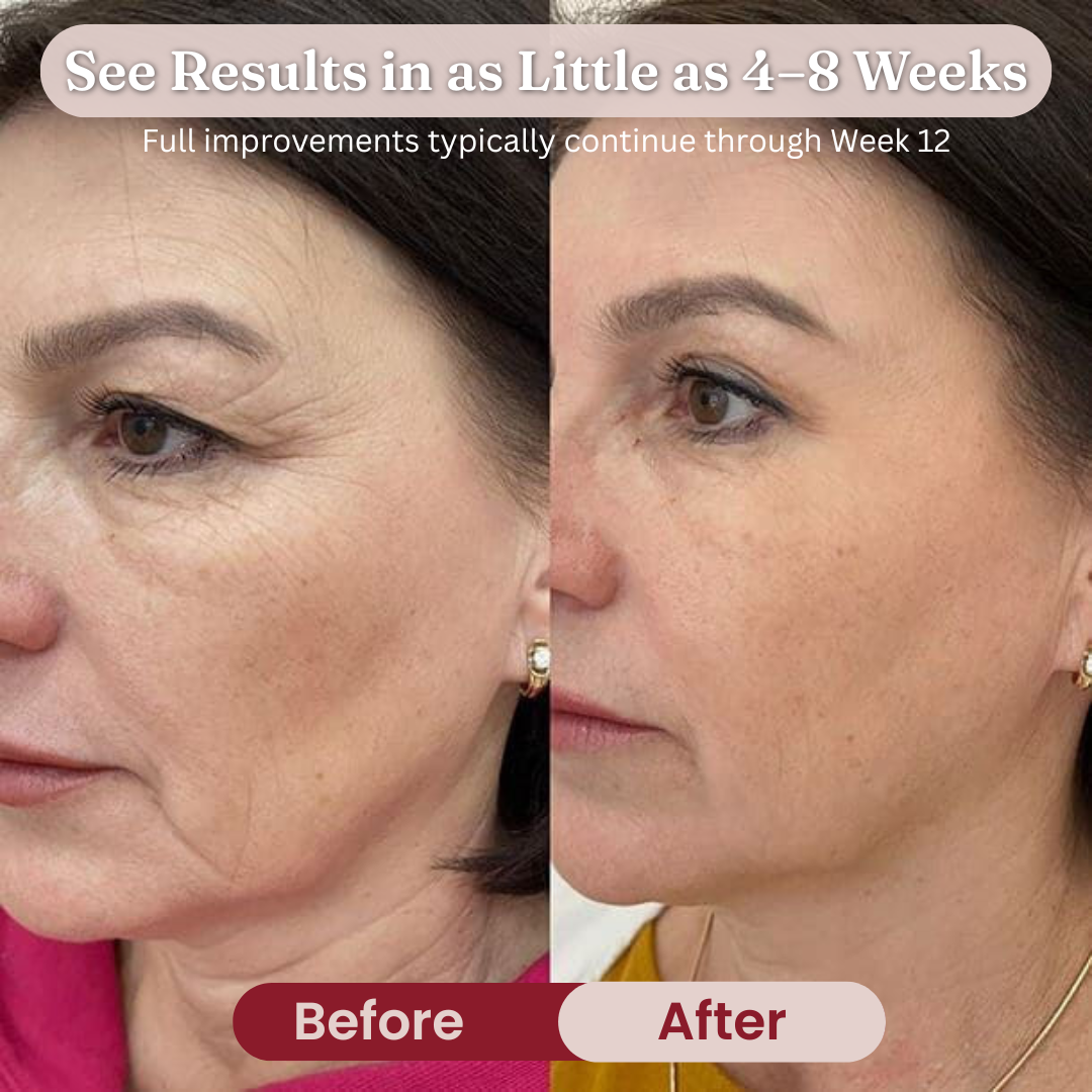 Get Your Youthful Skin Back