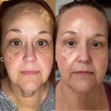 <h2><strong>Loved by Women Who Want to Age Gracefully — Not Perfectly</strong></h2><p></p>