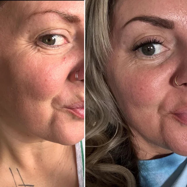 <h2><strong>Loved by Women Who Want to Age Gracefully — Not Perfectly</strong></h2><p></p>