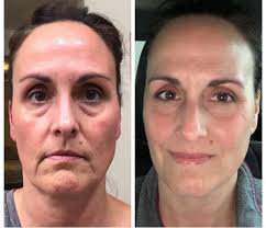 <h2><strong>Loved by Women Who Want to Age Gracefully — Not Perfectly</strong></h2><p></p>